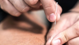 acupuncture-practice-new-york