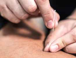 SBA Pre-Approved Profitable Acupuncture Practice